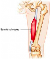 Origin 
Ischial tuberosity


Insertion
Medial surface of tibia (pesanserinus)	


Action 
Hip extensionKnee flexionInternal rotation of leg



Innervation 
Sciatic nerve (L5, S1, S2)
