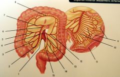 Superior/Inferior Mesenteric Arteries:

1 - 4
