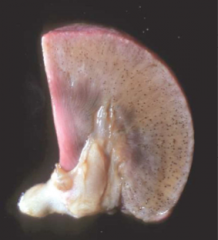 What disease is seen in this kidney?


What are the two forms of this disease and which is most common in domestic animals?


 