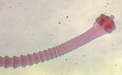 Canine tapeworm, most common, double pored = proglottids have a lateral pore on each side of their long edge at mid point