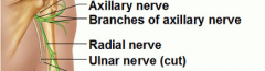 axillary, radial, ulnar