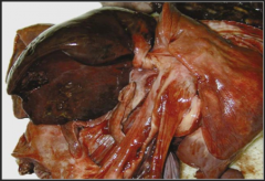 Is this venous or arterial infarction or both?


How can you tell?