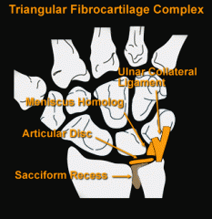 -radial collateral ligament on lateral side


-triangular shaped disc on the ulna (part of triangular fibrocartilage complex (TFCC)) that connected to triquetrium and lunate via ulnar collateral ligament medially`