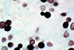 Histoplasma in Yeast form in tissue (no longer a mycelium in tissue) = dimorphic