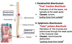 Parabrochial "True"
Epiphrenic "False"