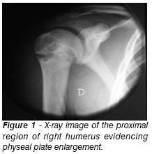 80% of growth in the humerus bone occured from the proximal humerus. Therefore, the distal humerus is responsible for the remaining 20% of growth.Ans1