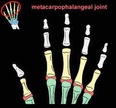 condyloid joints


palmar, transverse and collateral ligaments (tight in flexion)