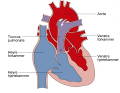 
Ductus avhengig systemisk sirkulasjon
Hvis tilstrekkelig alvorlig obstruksjon av venstre hjertehalvdel blir arteriell sirkulasjon avhengig av høyre-venstre shunting gjennom DA.
- Kritisk koarktasjon, aortastenose, hypoplastisk venstre hjertes...