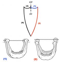(1) & (3) are superior contact borders determined primarily by tooth contact. Concavity due to incisal edges to dipping to clear the maxillary arch.
(2) & (4) are lateral borders that produce convex pathways. The lateral maximum is reached and li...