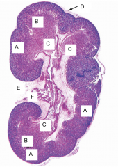 This is an image of a kidney. What is A?