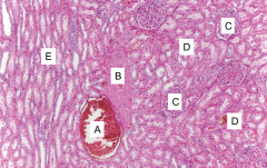 This is an image of the renal cortex. What is A?
