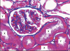 This is an image of the renal cortex. What is X?