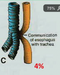 Looks like H


Esophagus is continuous with trachea and bronchi
