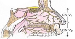The Pterygopalatine ganglia gives off the Nasopalatine branch. This nerve branches into the
- Posterior superior lateral + Posterior Inferior Lateral nasal branches.
- Sphenopalatine banch that tavels alog the anterior nasal septum, diverges throu...