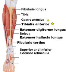 Note: the extensor digitorum longus and extensor hallucis longus are referred to as the anterior extensor compartment muscles