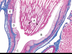 This is an image of the renal papillae. What is A?