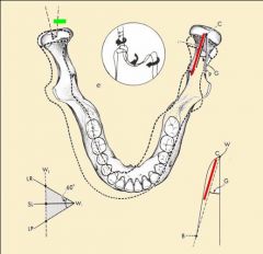 Bennett movement - a bodily side shift of the condyle on the working side in conjunction with rotation (GREEN);


Bennett Angle - The angle made by the sagittal plane and a line drawn from the point of origin of the balancing condyle to the fina...