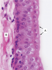 This is an image of the epithelium of the urinary system. What type of epithelium is this?