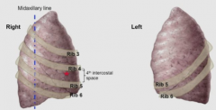 4th intercostal space ; ribs 4-6

superior lobe- rib 3