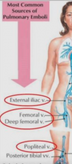 1. External iliac v
2. Femoral v
3. Deep femoral v
4. Popliteal v

Common sources are from lower limb deep veins