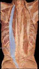 Vertebral column extension and lateral flexion