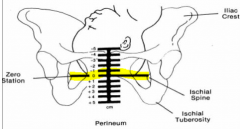 Depth of presenting part cf. Ischial spine 


 


-described in cm or fifths 


 


(    - 5cm-->0 cm )
