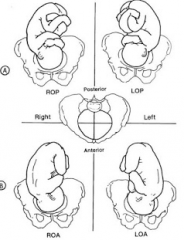 Orientation of presenting part 


 


-Right/Left  occipito Anterior/posterior 