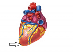 Tip of L Ventricle;