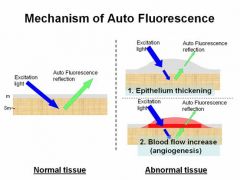 The electrons get exposed to a source of energy, they will get excited. When the excitation stops, the electron will get back to the ground state, releasing energy, in the form of fluorescence. In our tissues, we have different fluorophores, locat...