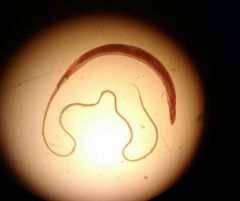 What worm is show here on the dissecting scope?