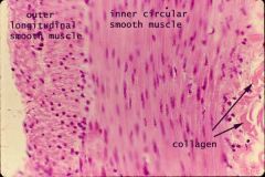 2 layers of smooth muscle: wide band (easy to see; cause constrict) and longitudinal smooth muscle (shorten and dilate)


- nuclei of circular  smooth muscle