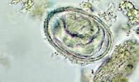 Metastrongylus Apri
Nematode
Needs earthworm host