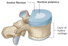 Cushion-like pads between vertebrae that act as shock absorbers. they are composed of: nucleus pulposus and the anulus fibrosus.