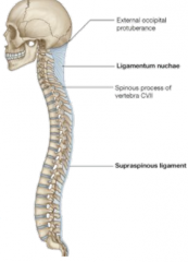 Ligaments: Ligamentum
     nuchae:
     supraspinous ligament that extends from the base of the skull to C7.  Supraspinous
     ligament:
     interconnects the tips of the spinous processes of each vertebrae from C7
     to the sacrum    ...