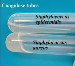 Differentiation between coagulase negative Staphylococci