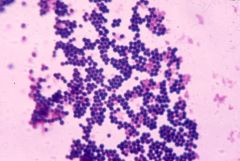 Staphylococcus areus