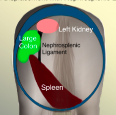 - Cause unknown (rolling?)
- Left dorsal/ventral colon entrapment between spleen and left body wall.
- Renosplenic ligament.
- Intestinal rupture and death may occur.