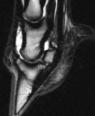 What type of MRI image is this?

What are some of the advantages of this type?