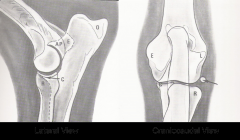 Elbow Lateral and CrCd