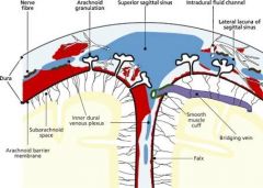 Superior cerebral veins cross the subarachnoid space - pierce dura (bridging veins) as they enter intracranial (dural) venous sinuses.
Arachnoid granulations allow CSF to flow into venous blood of sinuses but prevent backflow of blood into subarac...