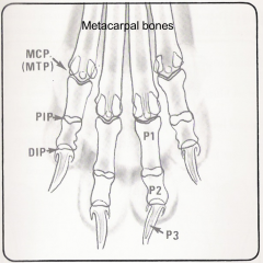 MCP = metacarpal phalangeal joint
PIP = proximal interphalangeal joint
DIP = distal interphalangeal joint
