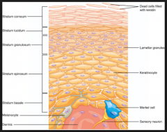 (C) The stratum corneum consists mainly of dead cells and keratin.