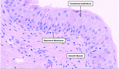 Urinary Bladder
The urinary bladder is lined by transitional epithelium, underneath which are thick layers of smooth muscle interwoven in various directions. This image shows a relaxed bladder where the epithelial cells appear cuboidal. In a dist...
