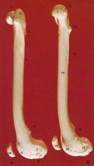 Femur Lateral and Medial
