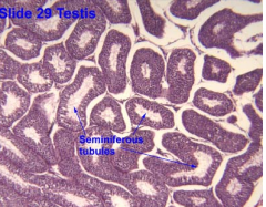 Note the highly coiled structure of the seminiferous tubules seen in cross section. The cell-type population varies from tubule to tubule depending in the stage of the spermatogenic cycle. The endocrine testis consists of the Leydig cells which ar...