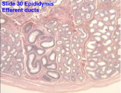 The efferent ductules have epithelia of variable height. The epididymal epithelium (pseudostratified columnar with stereocilia) is regular in height so that the luminal margin is even. Remember, this is a single tortuous duct. It has a thin layer ...