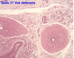 The vas deferens (ductas deferens) has a thick muscular wall and a narrow star-shaped lumen. You should note that the smooth muscle is arranged in 3 layers ; inner and outer longitudinal and middle circular. The lining epithelium is pseudostratifi...
