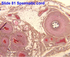 In the spermatic cord, there are bundles of nerve fibers , skeletal muscle , adipose tissue and blood vessels . Note the numerous veins (filled with blood) are atypical in that they resemble arteries and have (2) layers of smooth muscle. This is p...