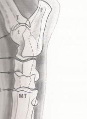 lateral tarsus