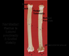Head      radial tubersoity
neck                                             nutrient foramen
                                                                       ulnar notch lateral

radius is lateral proximal and medially distally
